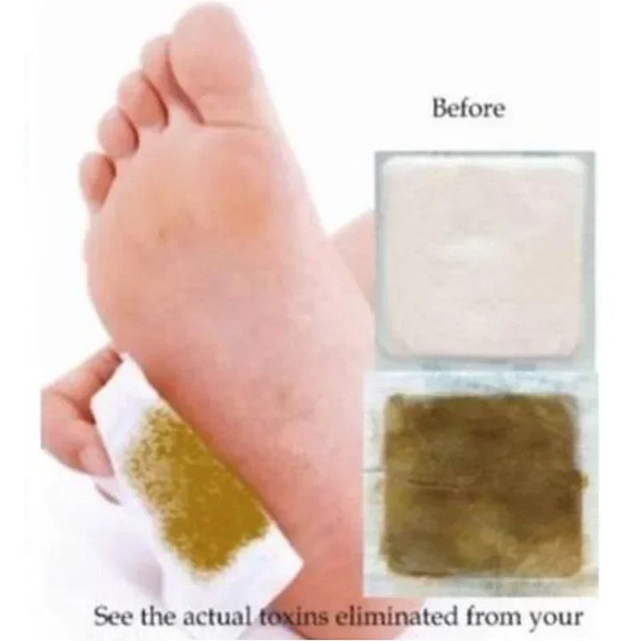 Korea Kinoki Cleansing Detox Leg Healthy Herbal Pads Feet Care Foot Spa Foot Care Dispel Dampness Sleep Well